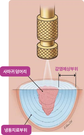 jin14_4_img